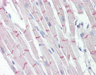 Desmoplakin Antibody in Immunohistochemistry (Paraffin) (IHC (P))