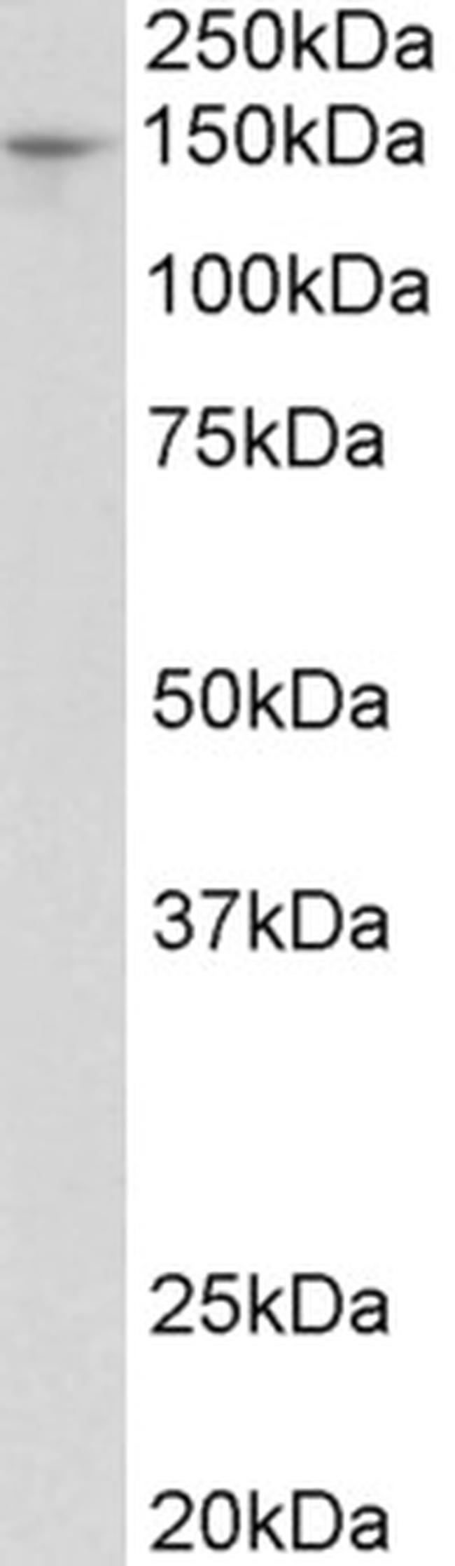 PEX1 Antibody in Western Blot (WB)