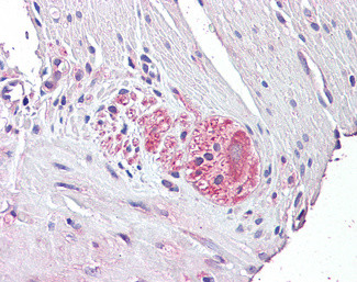 NTN4 Antibody in Immunohistochemistry (Paraffin) (IHC (P))