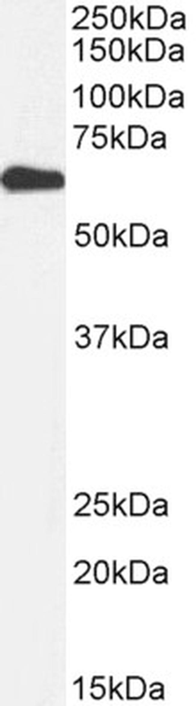 AMPK alpha-2 Antibody in Western Blot (WB)