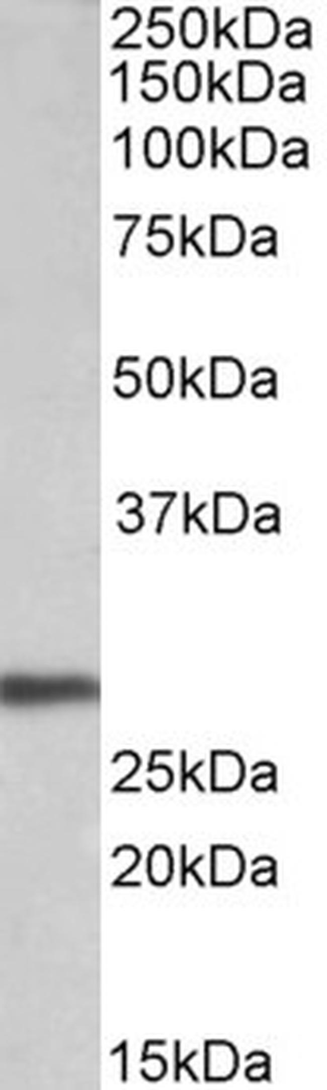 Artemin Antibody in Western Blot (WB)