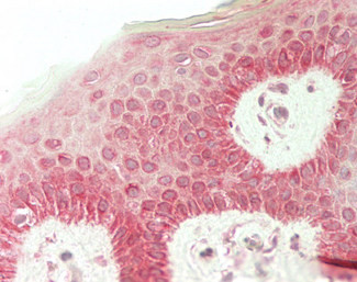 RHCG Antibody in Immunohistochemistry (Paraffin) (IHC (P))