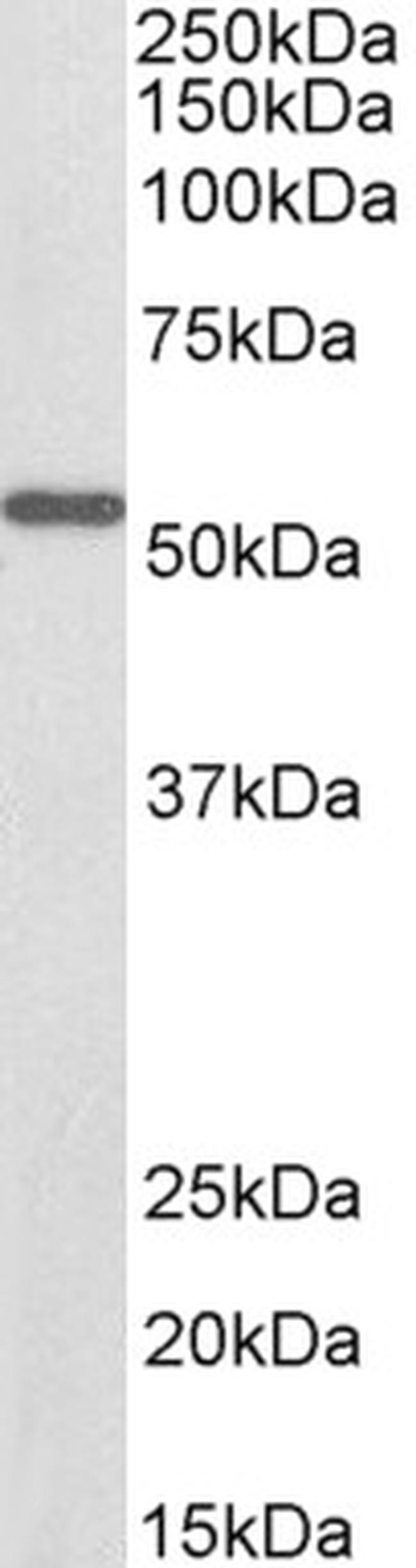 ALDH6A1 Antibody in Western Blot (WB)