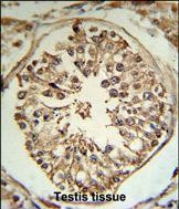 TMPRSS2 Antibody in Immunohistochemistry (Paraffin) (IHC (P))