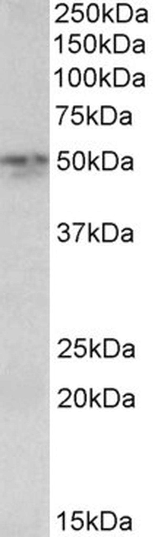 Synaptotagmin 2 Antibody in Western Blot (WB)