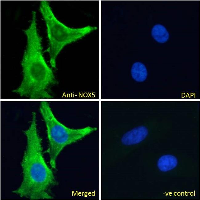 NOX5 Antibody in Immunocytochemistry (ICC/IF)