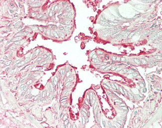 ARL6 Antibody in Immunohistochemistry (Paraffin) (IHC (P))