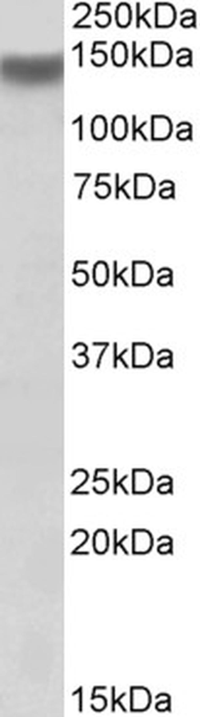 ITGA11 Antibody in Western Blot (WB)