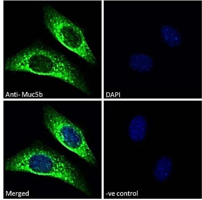 MUC5B Antibody in Immunocytochemistry (ICC/IF)