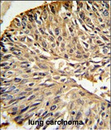 DHFR Antibody in Immunohistochemistry (Paraffin) (IHC (P))