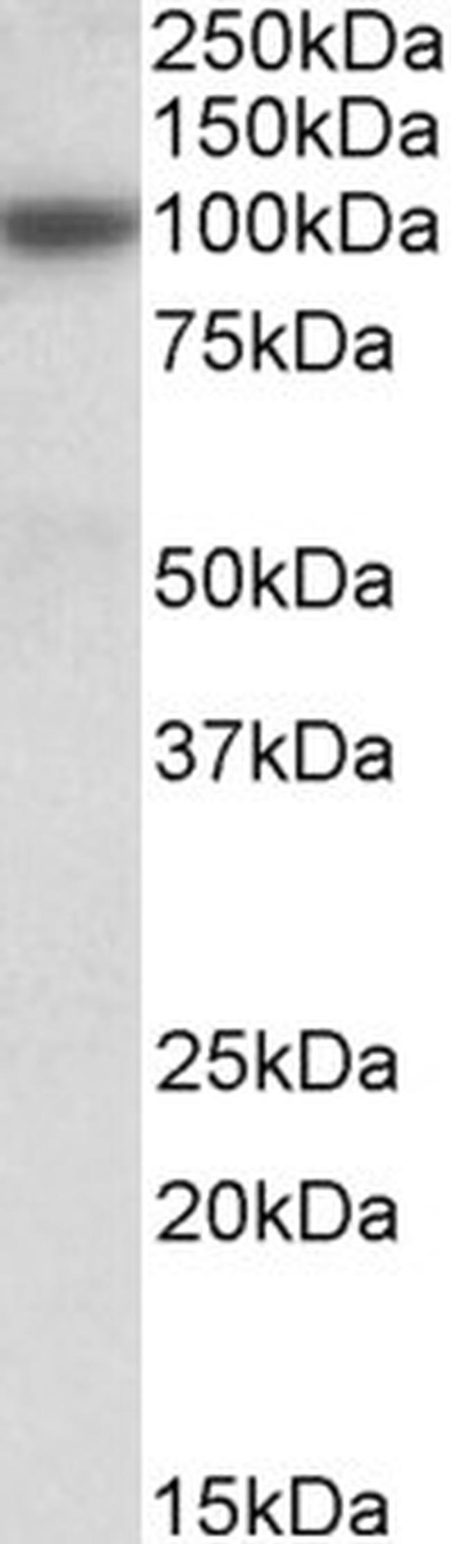 MRP4 Antibody in Western Blot (WB)