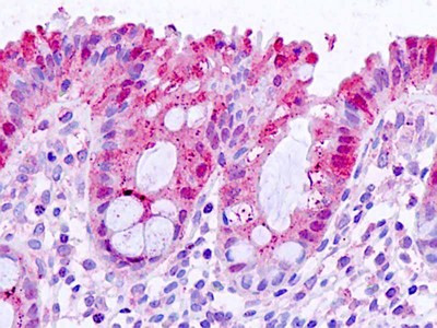 Galectin 3 Antibody in Immunohistochemistry (Paraffin) (IHC (P))