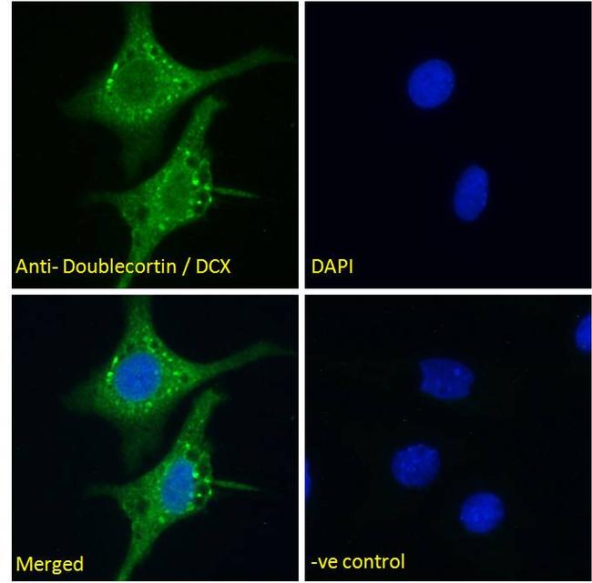 Doublecortin Antibody in Immunocytochemistry (ICC/IF)