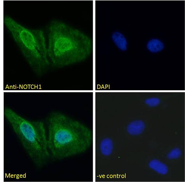 NOTCH1 Antibody in Immunocytochemistry (ICC/IF)