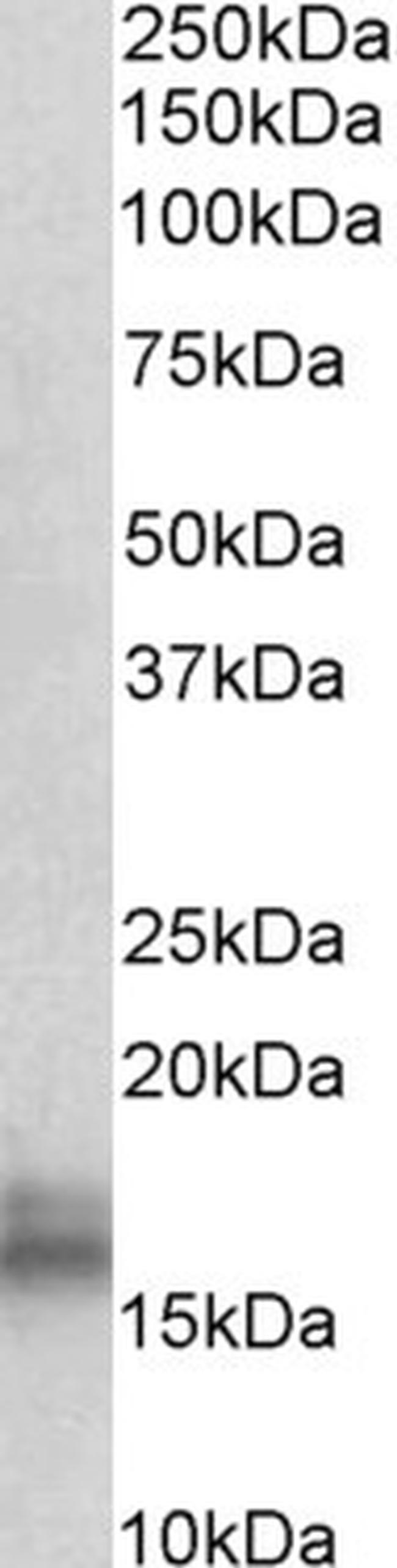 NPC2 Antibody in Western Blot (WB)