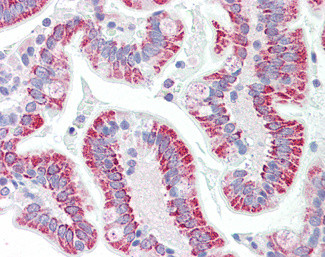 SON Antibody in Immunohistochemistry (Paraffin) (IHC (P))