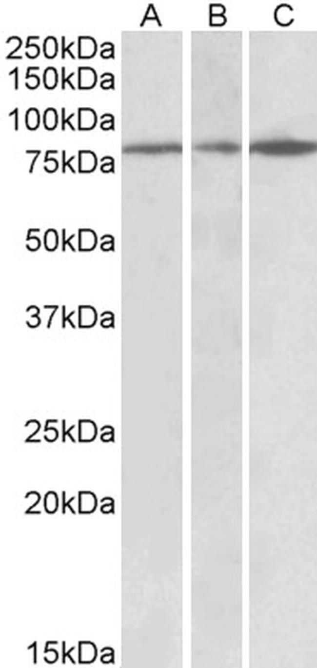 PAPD5 Antibody in Western Blot (WB)