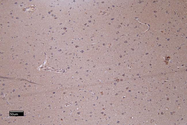 PTCH Antibody in Immunohistochemistry (Paraffin) (IHC (P))