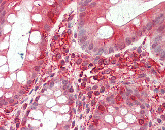 TFB2M Antibody in Immunohistochemistry (Paraffin) (IHC (P))