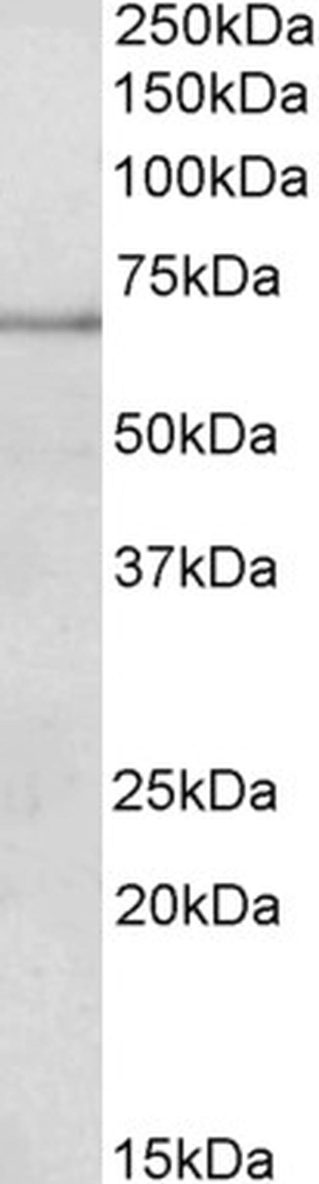 PAPD5 Antibody in Western Blot (WB)