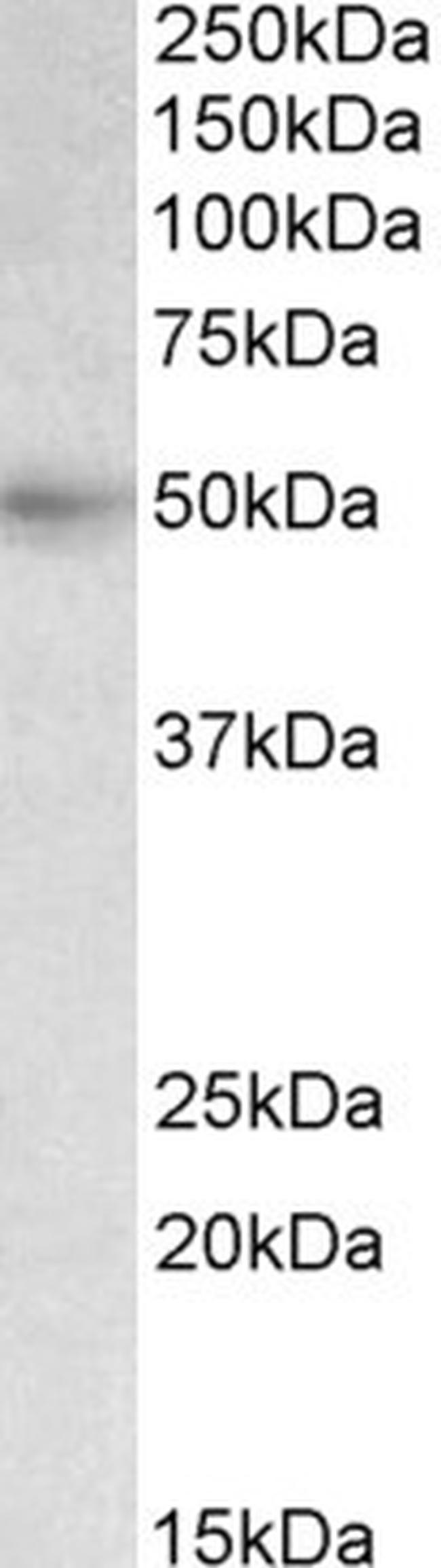 SLC46A1 Antibody in Western Blot (WB)