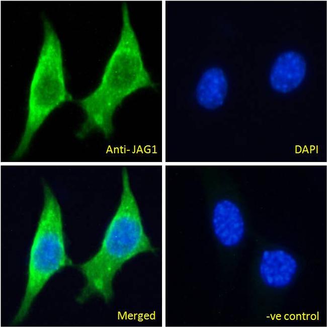 Jagged1 Antibody in Immunocytochemistry (ICC/IF)