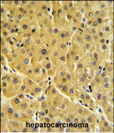 FBP1 Antibody in Immunohistochemistry (Paraffin) (IHC (P))