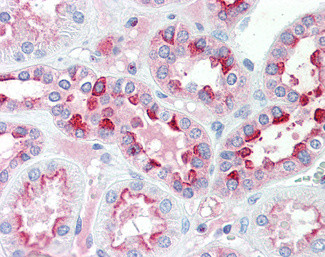 IDH3G Antibody in Immunohistochemistry (Paraffin) (IHC (P))