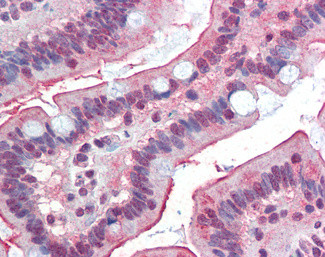 DGAT1 Antibody in Immunohistochemistry (Paraffin) (IHC (P))