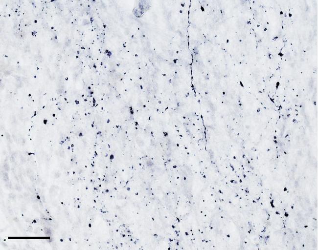 TPH2 Antibody in Immunohistochemistry (PFA fixed) (IHC (PFA))