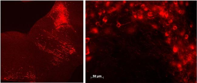 TPH2 Antibody in Immunohistochemistry (IHC)