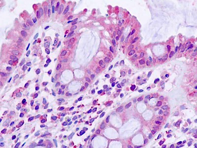 TGFBR1 Antibody in Immunohistochemistry (Paraffin) (IHC (P))