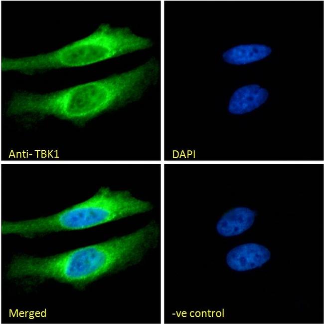 TBK1 Antibody in Immunocytochemistry (ICC/IF)