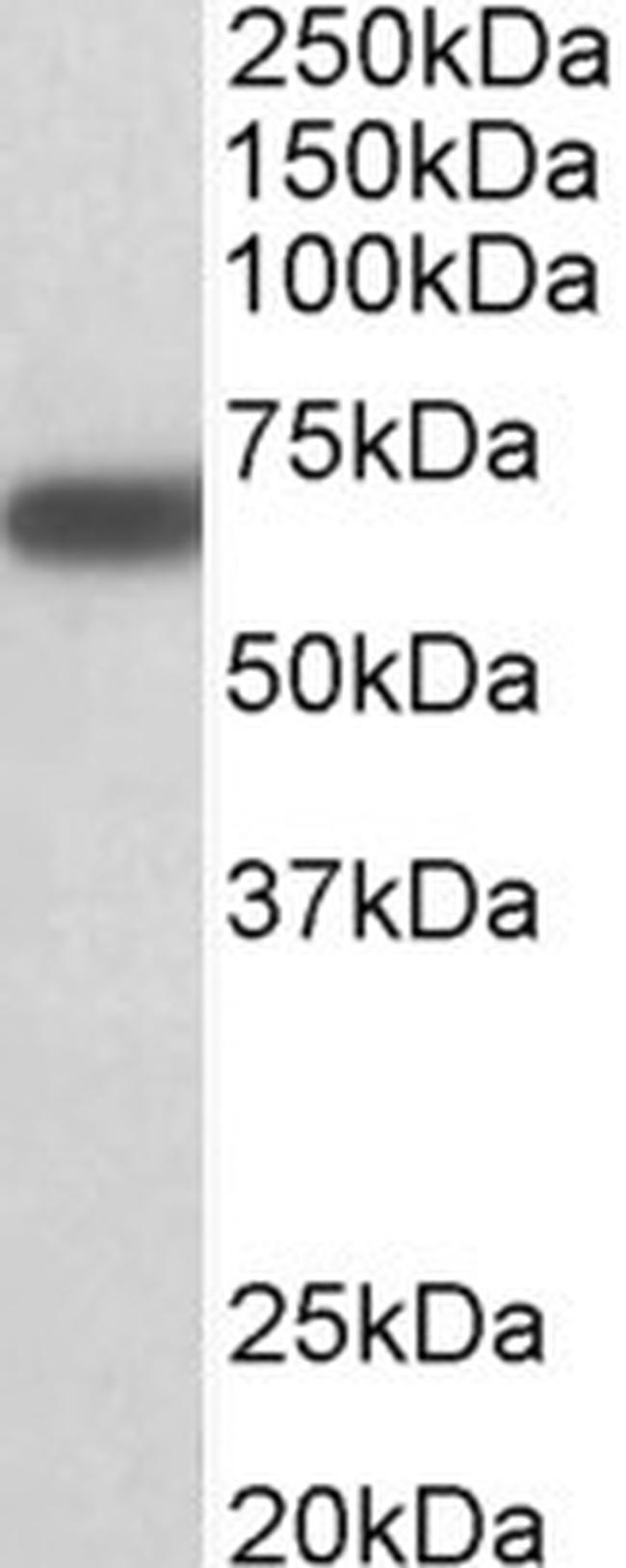 GAD67 Antibody in Western Blot (WB)