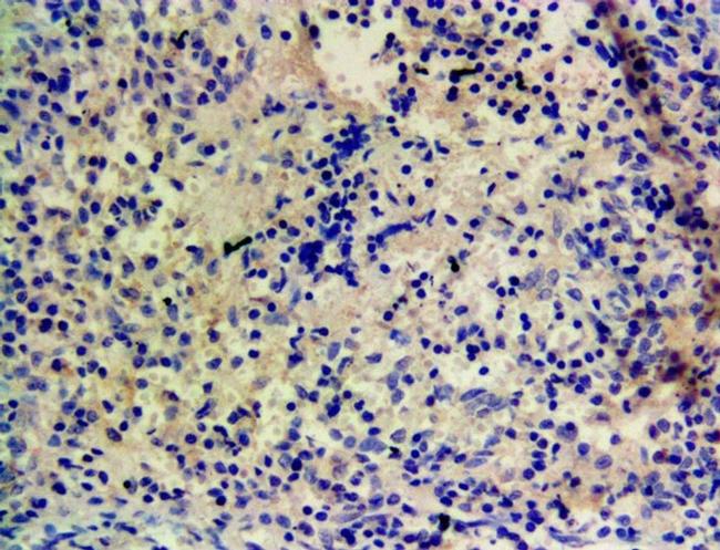 CYP1A1 Antibody in Immunohistochemistry (Paraffin) (IHC (P))