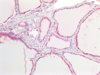 E-cadherin Antibody in Immunohistochemistry (Paraffin) (IHC (P))