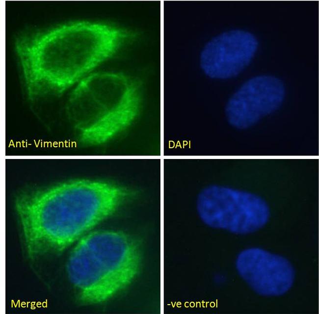 Vimentin Antibody in Immunocytochemistry (ICC/IF)