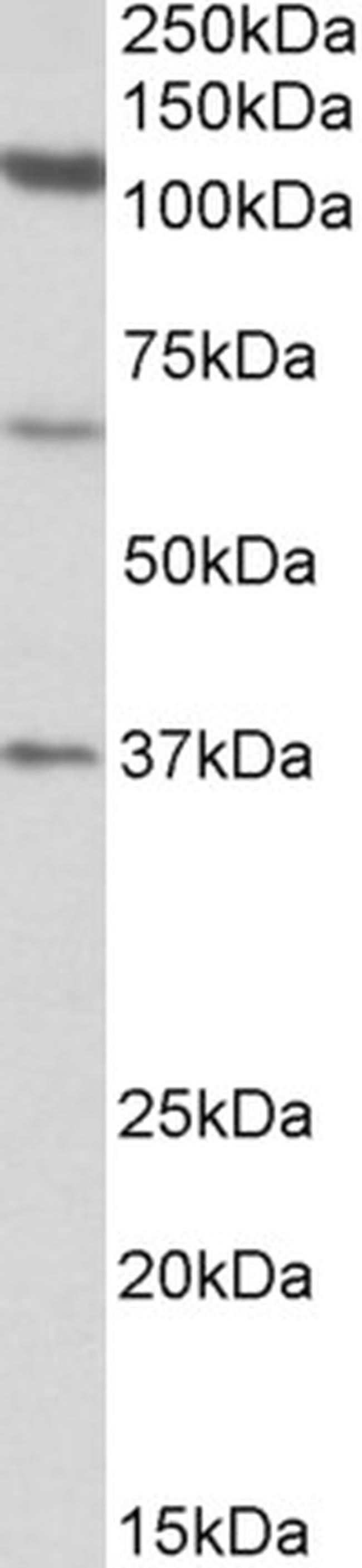 CP110 Antibody in Western Blot (WB)