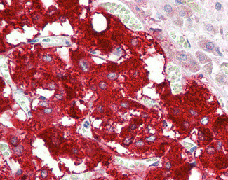 Dopamine beta Hydroxylase Antibody in Immunohistochemistry (Paraffin) (IHC (P))