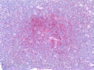 IRF4 Antibody in Immunohistochemistry (Paraffin) (IHC (P))