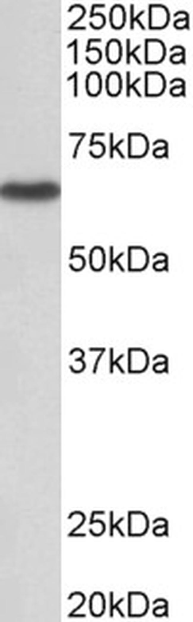 MST2 Antibody in Western Blot (WB)