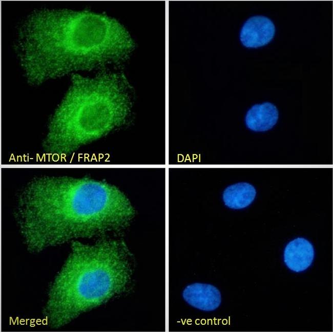 mTOR Antibody in Immunocytochemistry (ICC/IF)