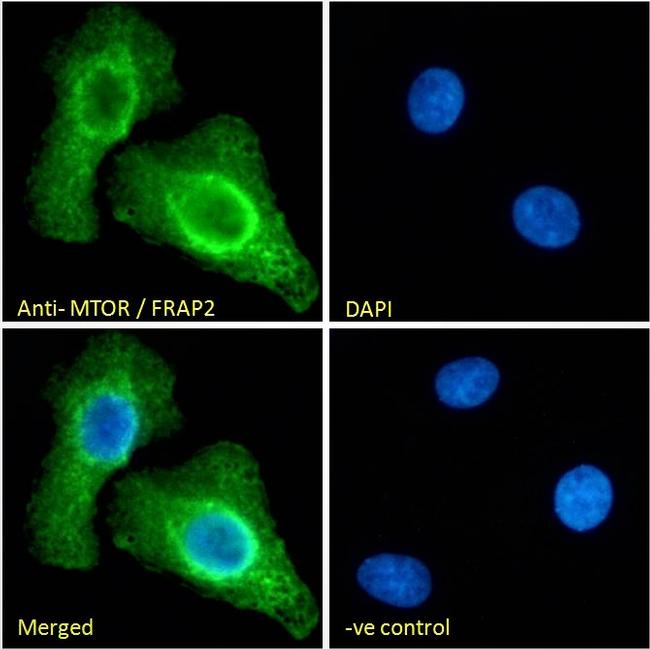 mTOR Antibody in Immunocytochemistry (ICC/IF)