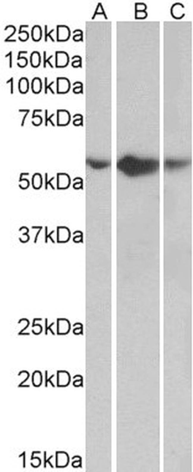 TNFR1 Antibody in Western Blot (WB)