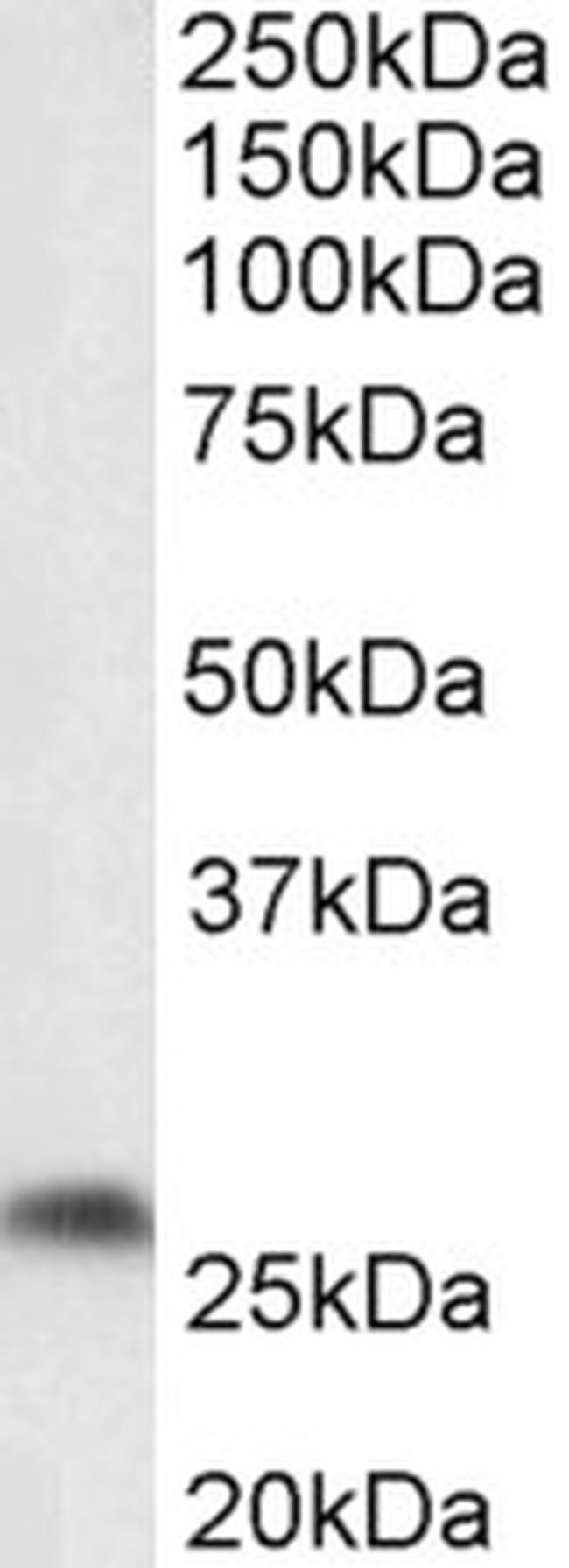 PTGDS Antibody in Western Blot (WB)