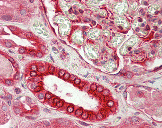 DVL1 Antibody in Immunohistochemistry (Paraffin) (IHC (P))