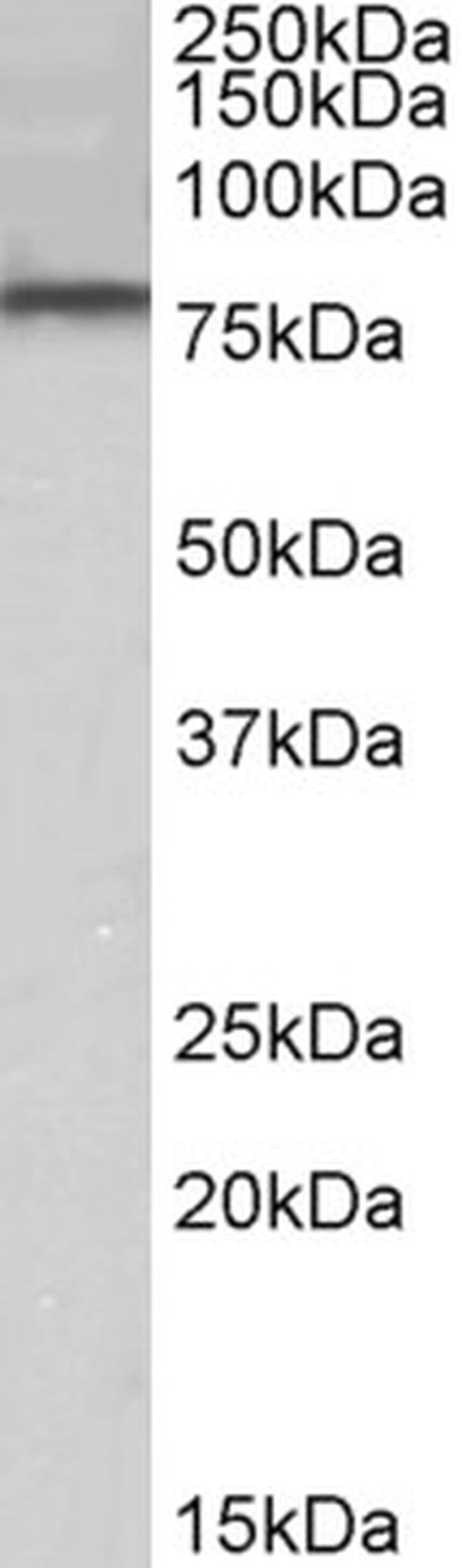 DYRK1A Antibody in Western Blot (WB)