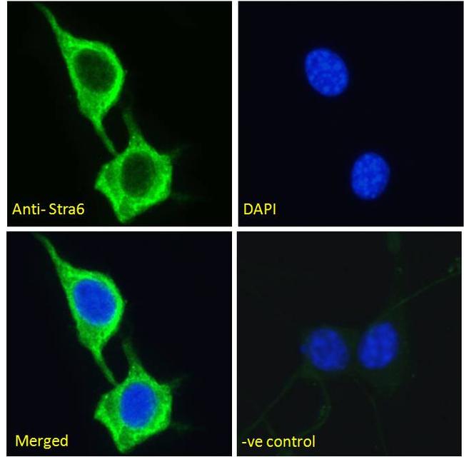 STRA6 Antibody in Immunocytochemistry (ICC/IF)