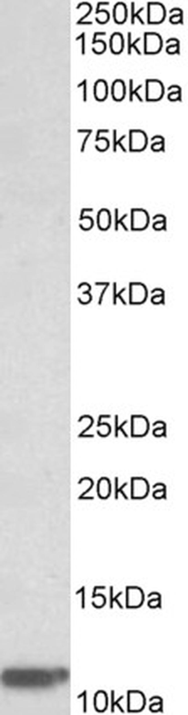 beta-2 Microglobulin Antibody in Western Blot (WB)