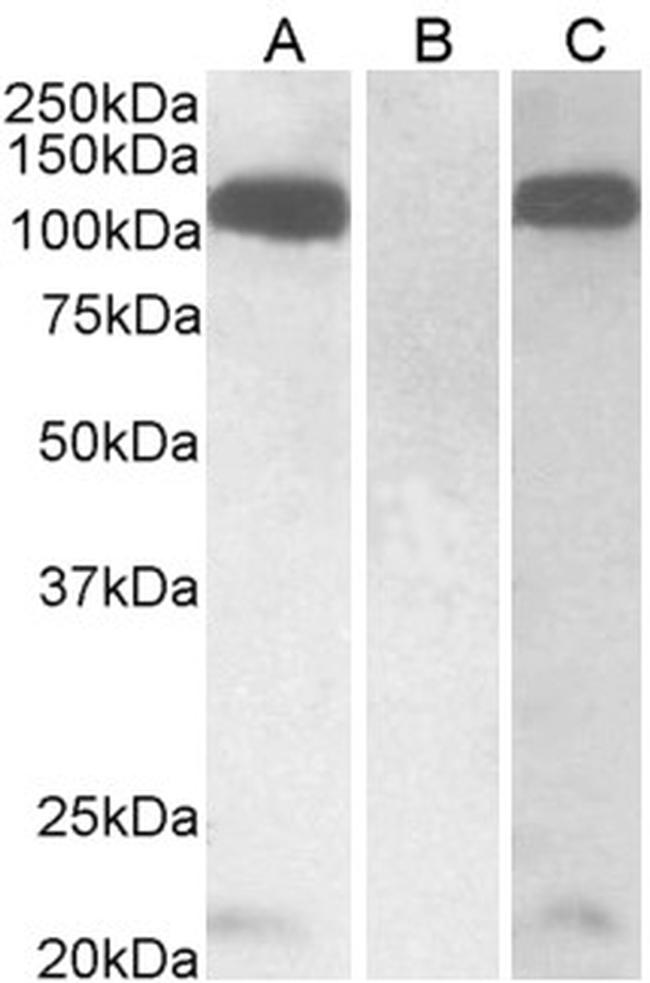 Furin Antibody in Western Blot (WB)